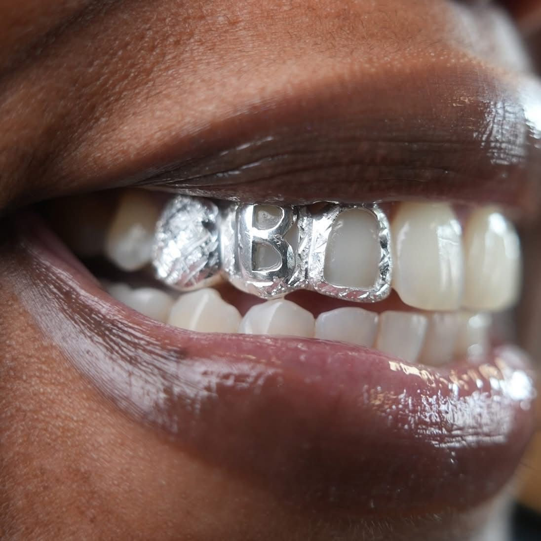 Custom 10K Gold Grillz