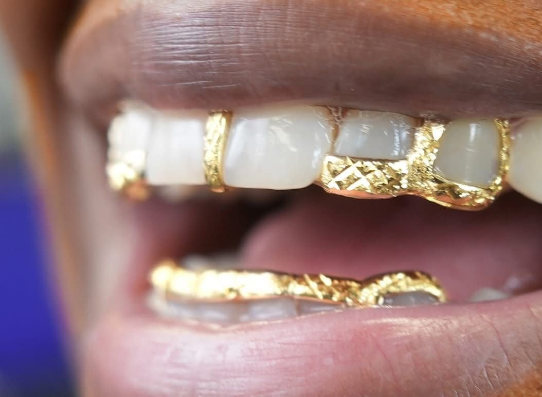Custom 10K Gold Grillz