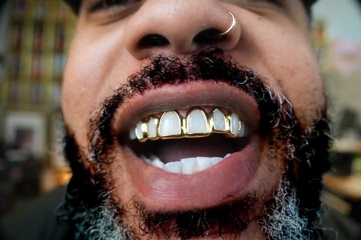 Custom 10K Gold Grillz