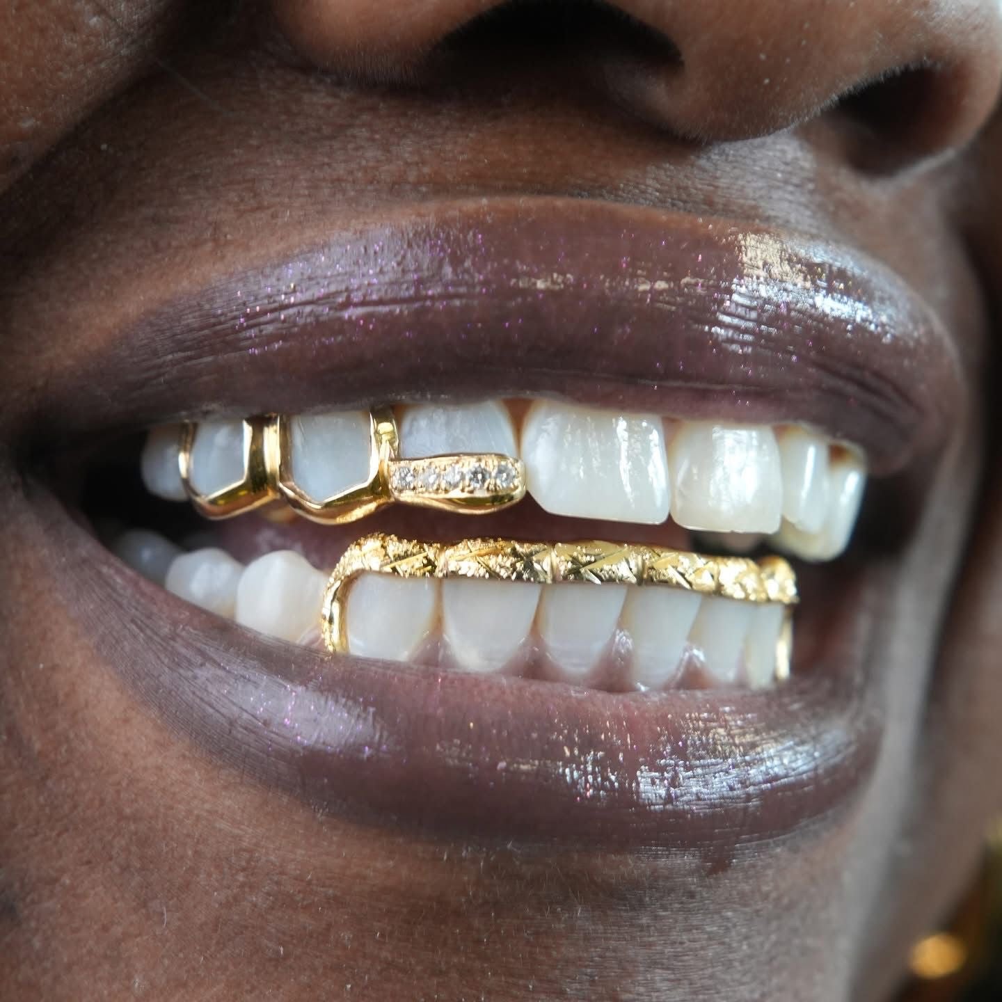 Custom 10K Gold Grillz