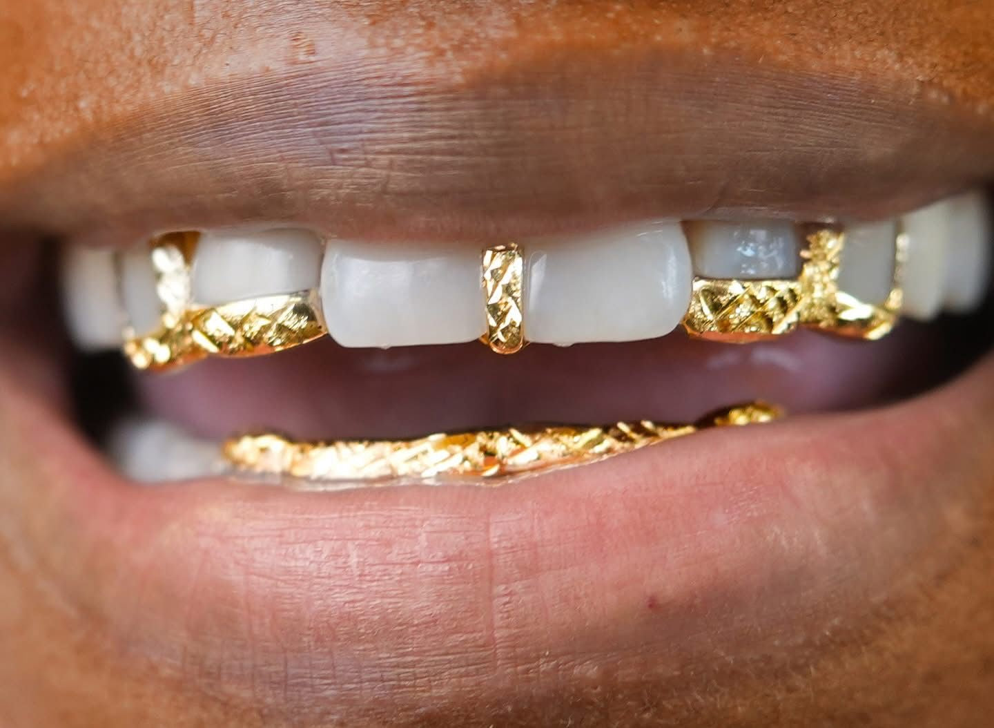 Custom 10K Gold Grillz