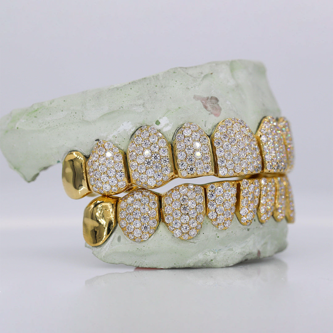 Custom 10K Gold Grillz