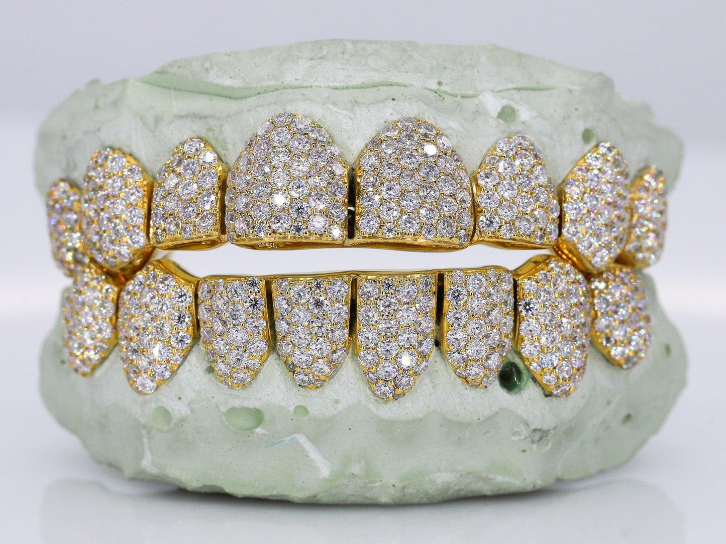 Custom 10K Gold Grillz