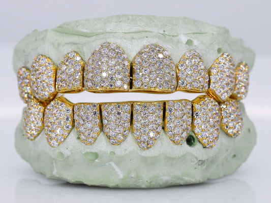 Custom 10K Gold Grillz