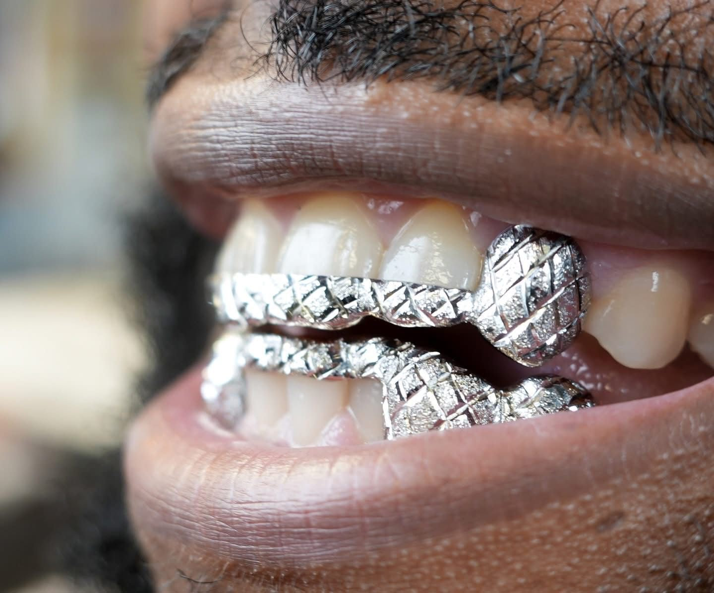 Custom 10K Gold Grillz