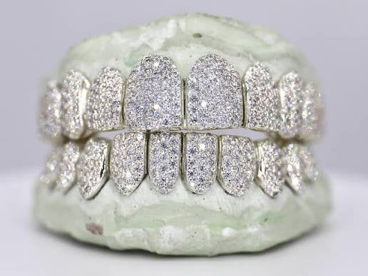Custom 10K Gold Grillz