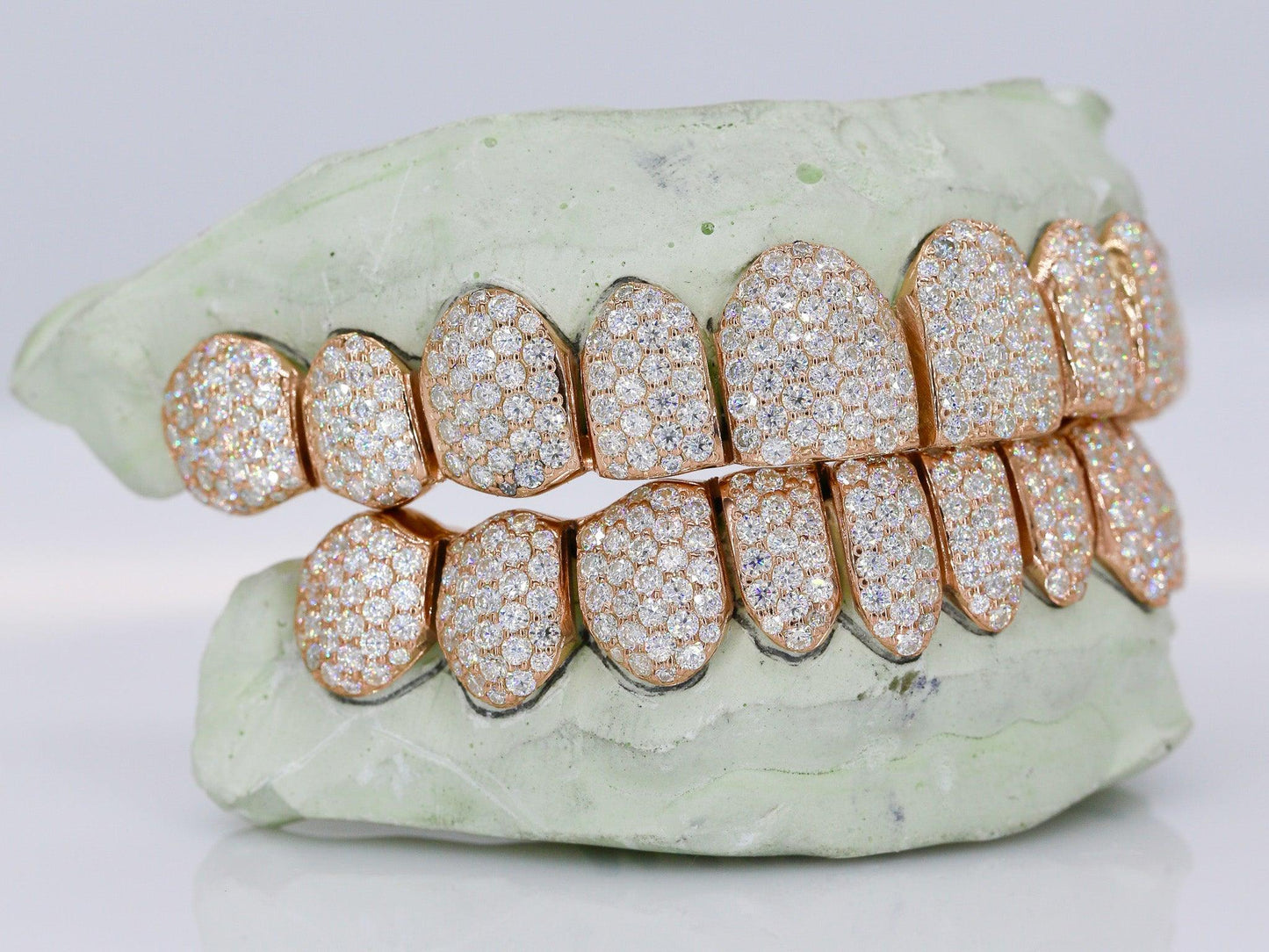 Custom 10K Gold Grillz