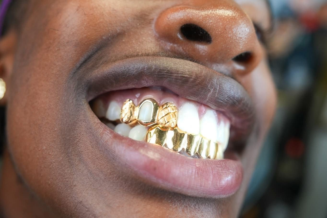Custom 10K Gold Grillz