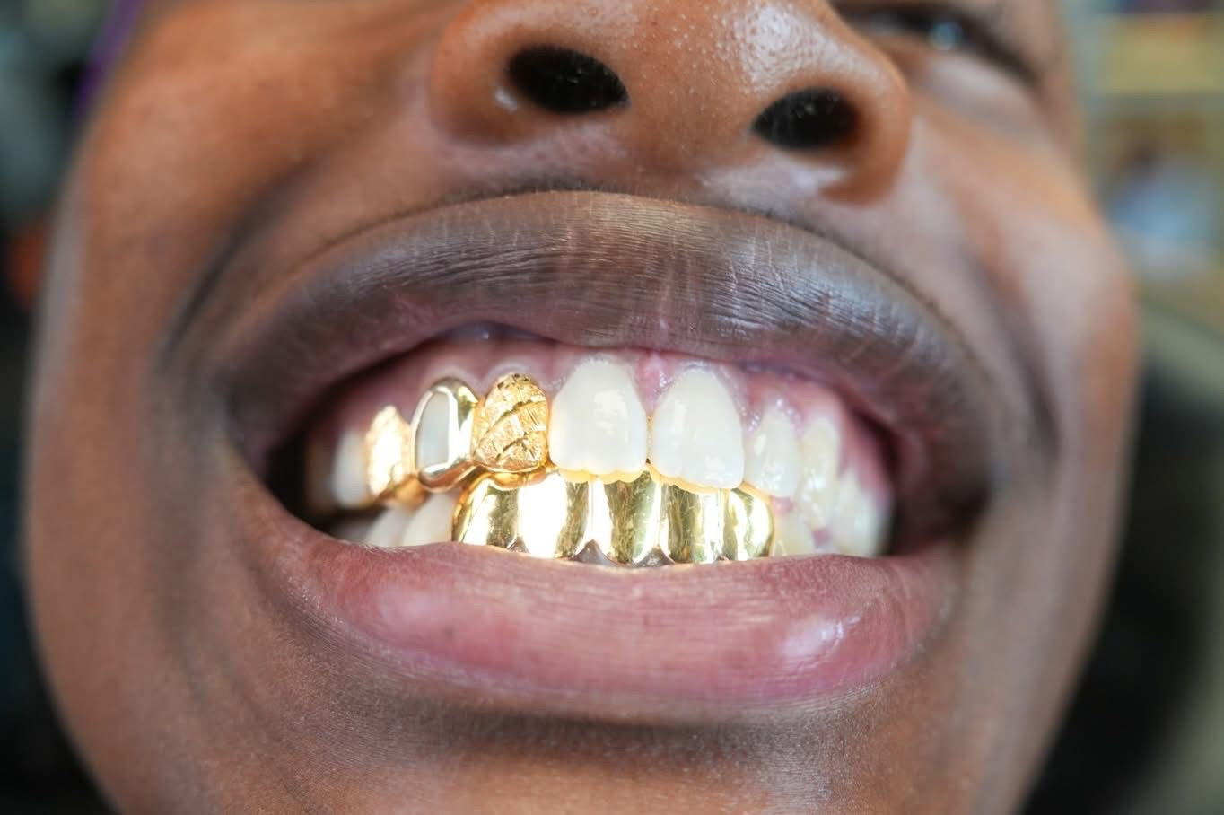 Custom 10K Gold Grillz