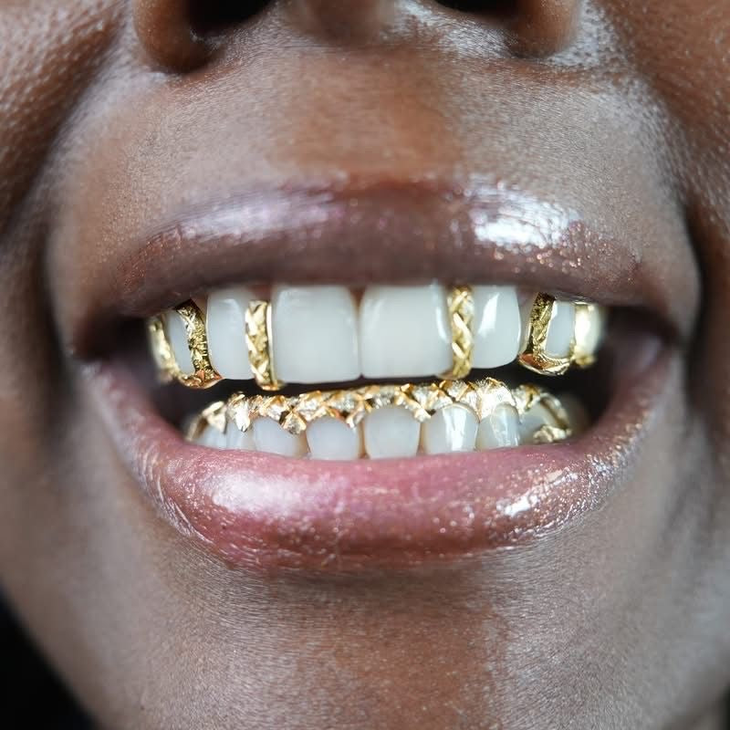 Custom 10K Gold Grillz