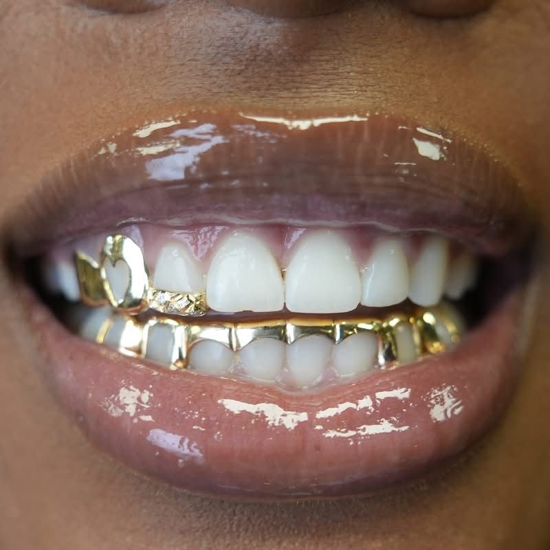 Custom 10K Gold Grillz