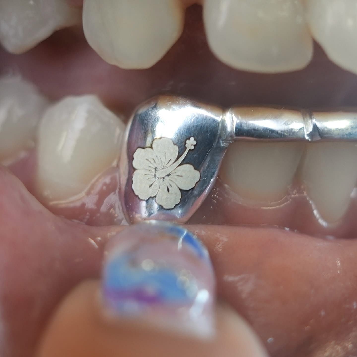 Custom 10K Gold Grillz