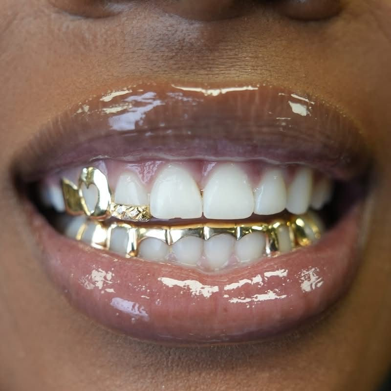 Custom 10K Gold Grillz